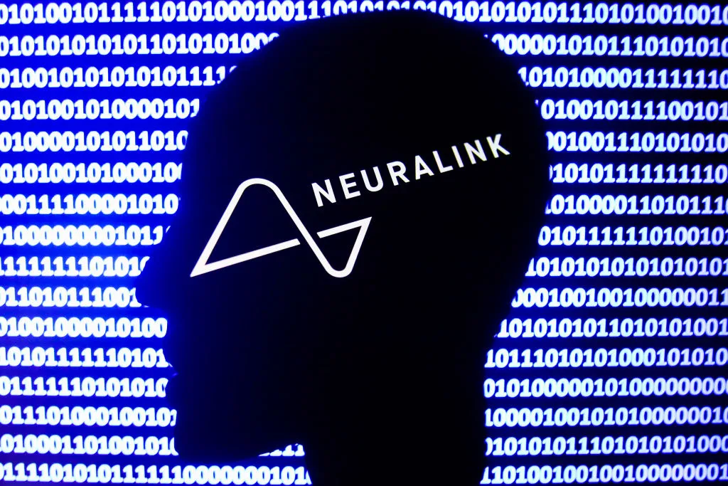 neuralink-implant.webp.0816306a767f8c28897a7a1ccfd1e816.webp