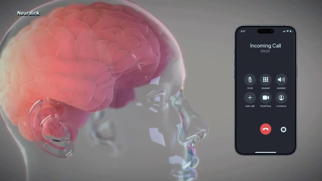 neuralink3-ht-ml-240130_1706626654072_hpEmbed_16x9.jpg.e6238513ae7a05bb6ce5a0c230112ebc.jpg